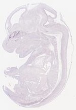 EMAGE:29352