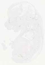 EMAGE:29359