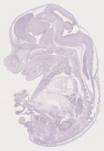 EMAGE:29368