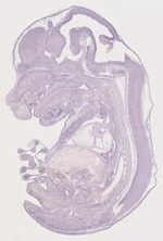 EMAGE:29368
