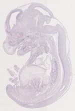 EMAGE:29368