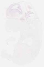 EMAGE:29372