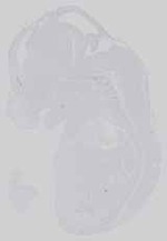 EMAGE:29406