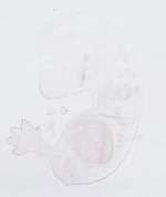 EMAGE:29440