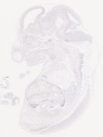 EMAGE:29458