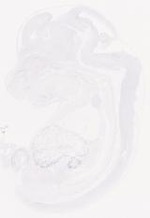 EMAGE:29458