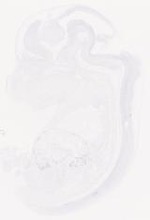 EMAGE:29458