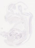 EMAGE:29458