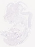 EMAGE:29458