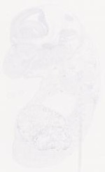 EMAGE:29458