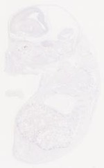 EMAGE:29458