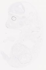 EMAGE:29458