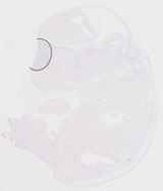 EMAGE:29459
