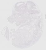 EMAGE:29469