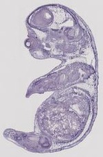EMAGE:29471