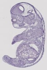 EMAGE:29471