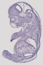 EMAGE:29471