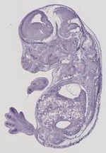 EMAGE:29471