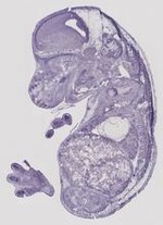 EMAGE:29471