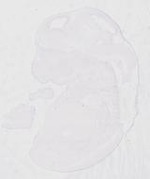 EMAGE:29474