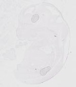 EMAGE:29474