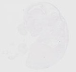 EMAGE:29474