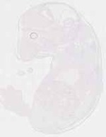 EMAGE:29479