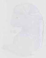 EMAGE:29489