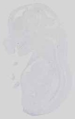 EMAGE:29492