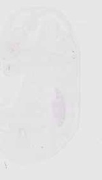 EMAGE:29503
