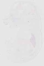 EMAGE:29503