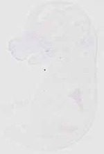 EMAGE:29503