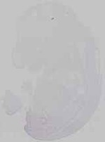 EMAGE:29534