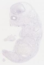 EMAGE:29551