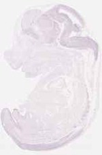 EMAGE:29562