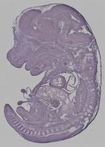 EMAGE:29578