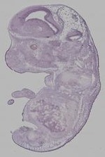 EMAGE:29580