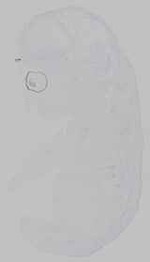 EMAGE:29583