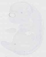 EMAGE:29588