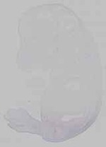 EMAGE:29592