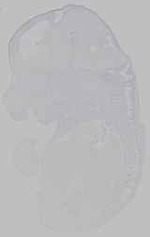 EMAGE:29602