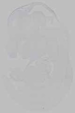 EMAGE:29602