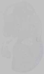EMAGE:29602