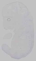 EMAGE:29602