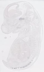 EMAGE:29608