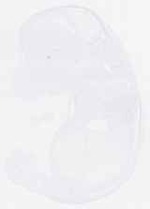 EMAGE:29625