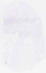 EMAGE:29625