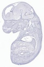 EMAGE:29631