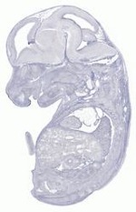 EMAGE:29631