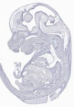 EMAGE:29631
